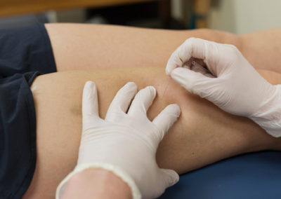 Points Trigger – Pré requis Dry Needling