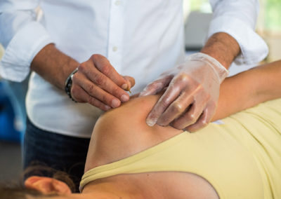 Douleurs myofasciales et Dry Needling – Quadrant supérieur