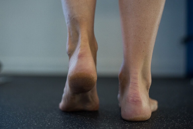 Gestion des tendinopathies du membre inférieur